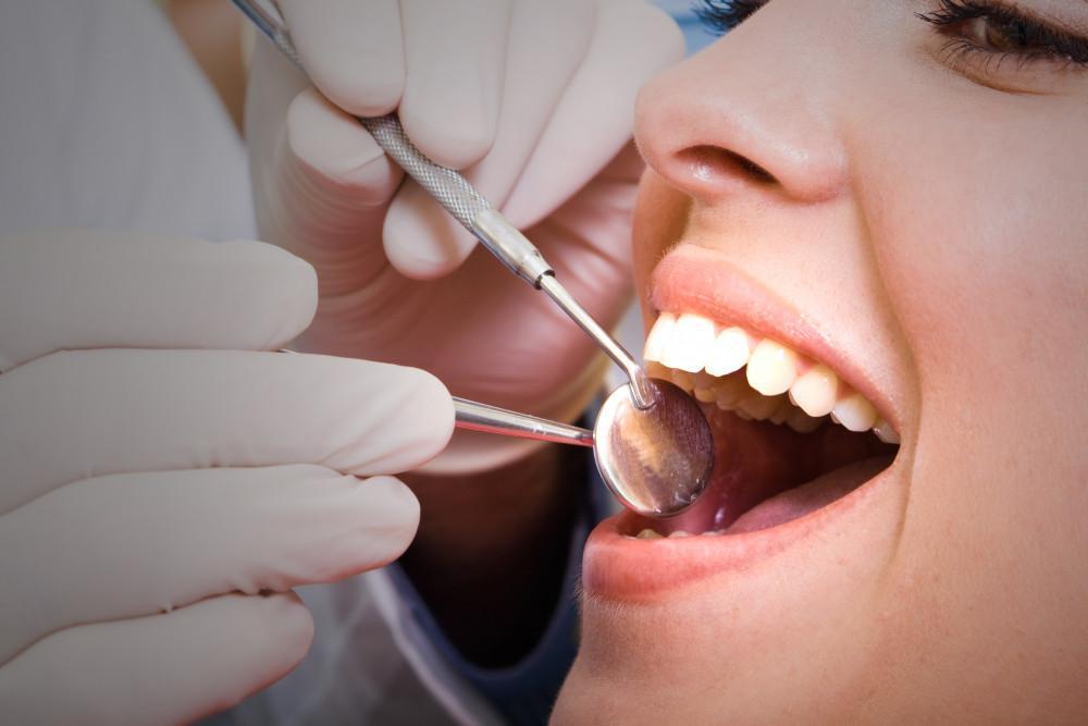 What is a Deep Dental Cleaning and Who Needs One?